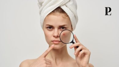 Les 5 raisons d'un acné persistant