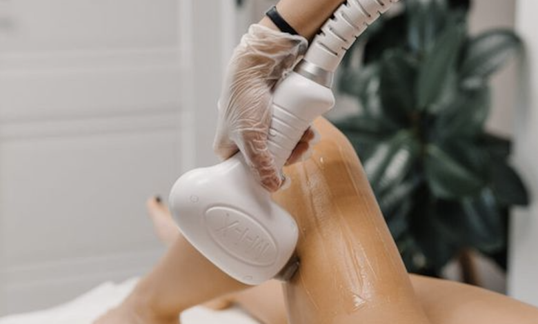 Épilation laser et sterilité: Mythe ou réalité